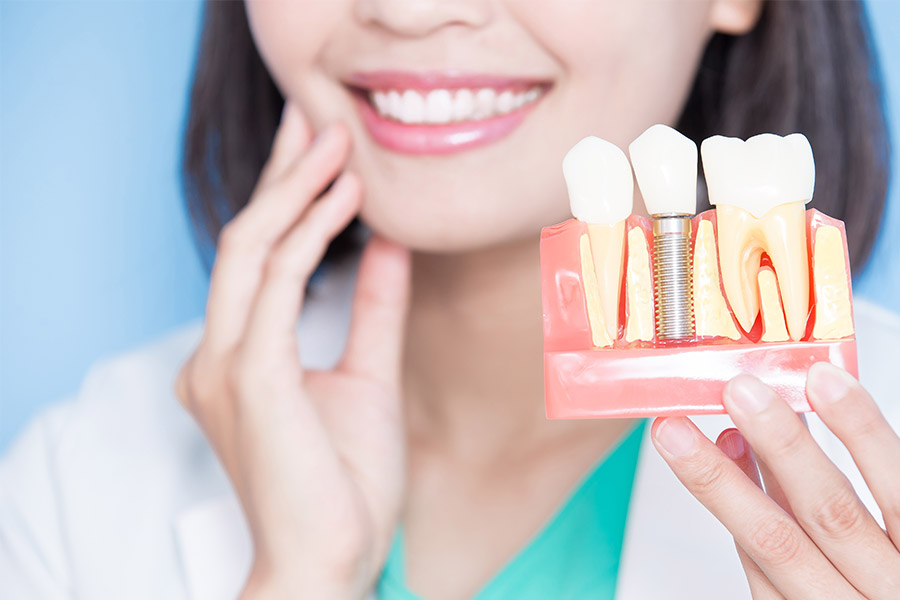 dental implants in kelowna